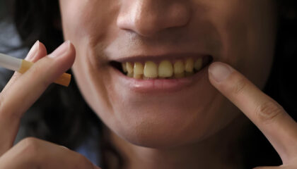 Why Are My Teeth Turning Yellow Even With Daily Brushing?