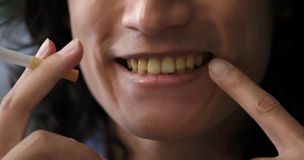 Why Are My Teeth Turning Yellow Even With Daily Brushing?