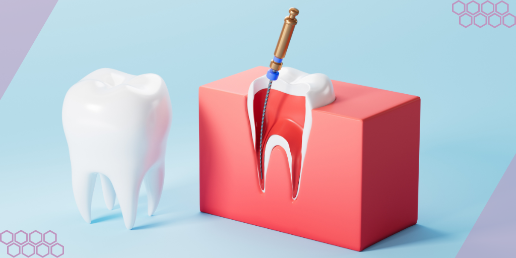 3D cross-section of a tooth showing a root canal file cleaning the inner canal