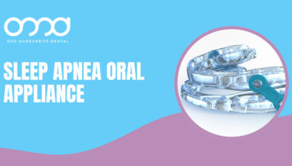 Sleep apnea oral appliance shown on a dental blog banner