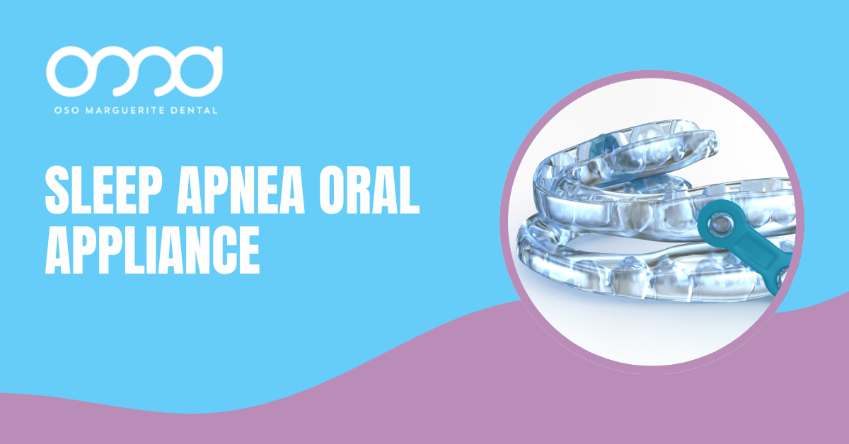 Sleep apnea oral appliance shown on a dental blog banner