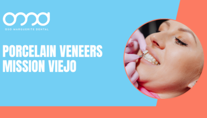 Dentist placing a porcelain veneer on a patient's tooth in Mission Viejo