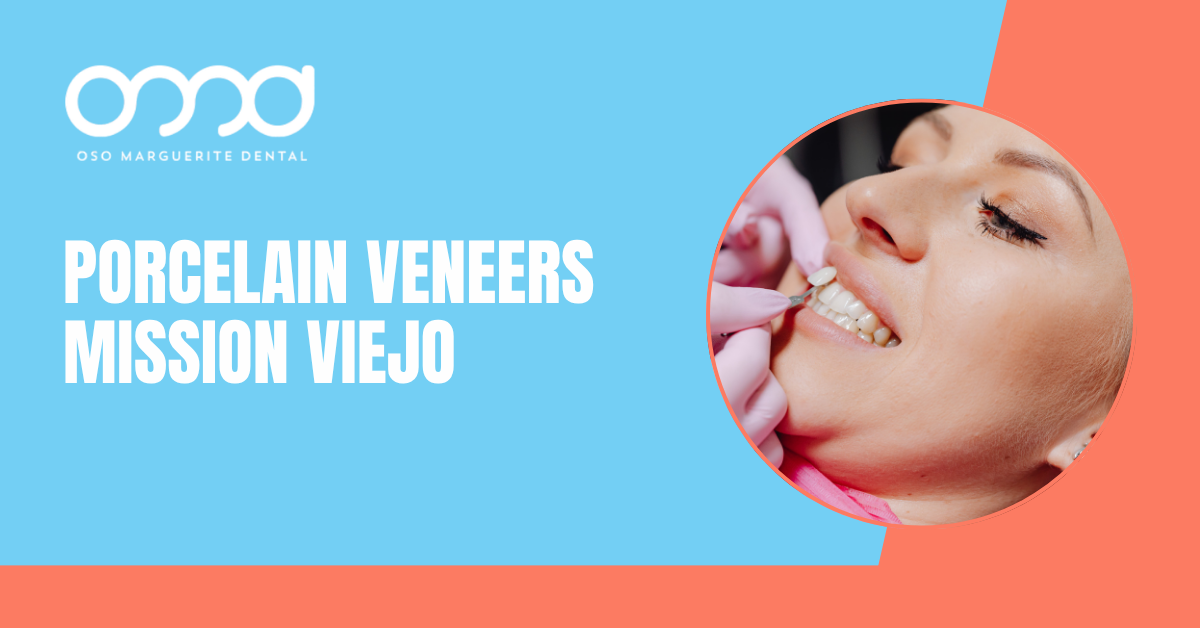 Dentist placing a porcelain veneer on a patient's tooth in Mission Viejo