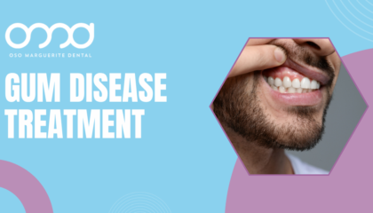 Man lifting his upper lip to show swollen gums needing gum disease treatment