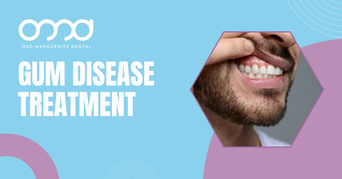 Man lifting his upper lip to show swollen gums needing gum disease treatment