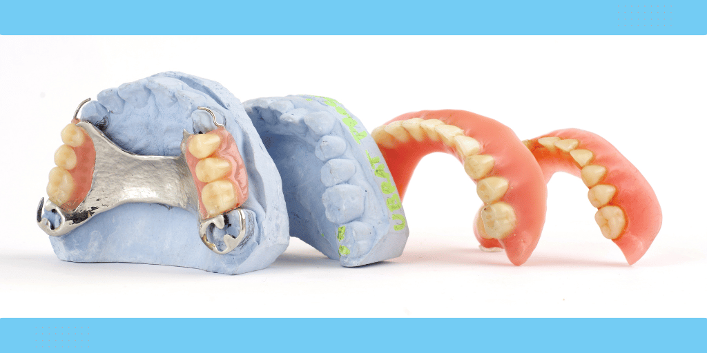 Partial denture on a dental cast beside two complete denture models