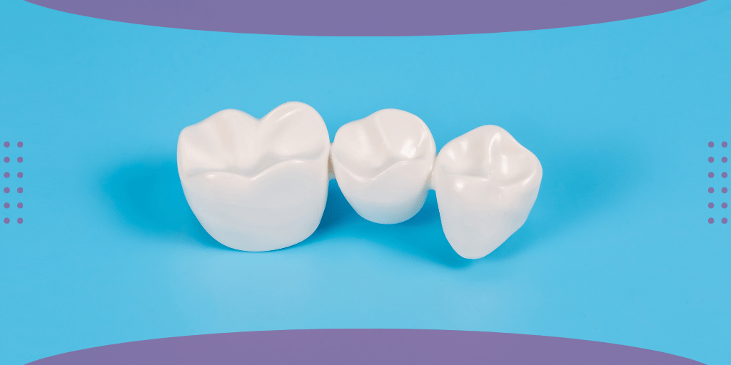 Porcelain dental crown close-up on a header graphic comparing crowns and veneers