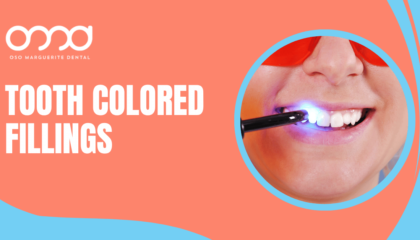 Curing light hardening a tooth colored filling on a header graphic comparing composite and amalgam fillings