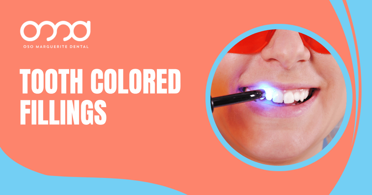Curing light hardening a tooth colored filling on a header graphic comparing composite and amalgam fillings