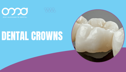 Three porcelain dental crowns of different sizes against a blue background
