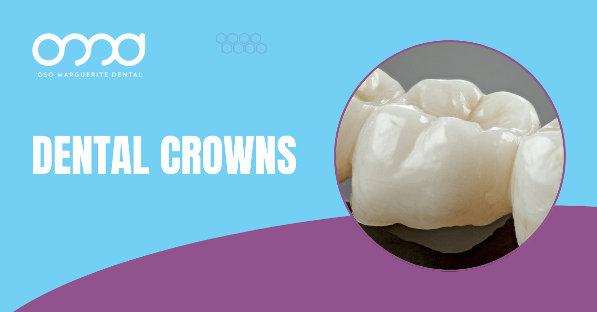 Three porcelain dental crowns of different sizes against a blue background